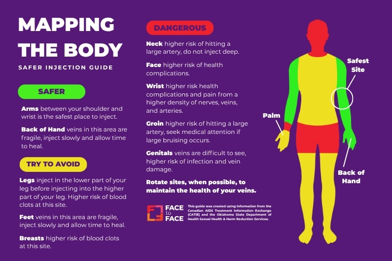 Mapping the Body – Safer Injection Guide